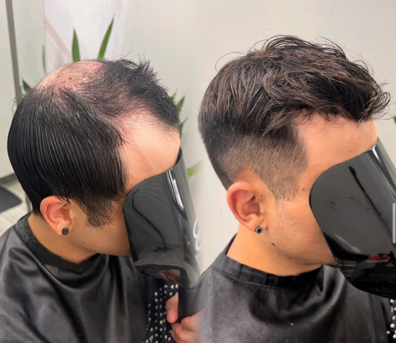 Men's hair system before-and-after result with dark styled hair in Kenosha, Wisconsin