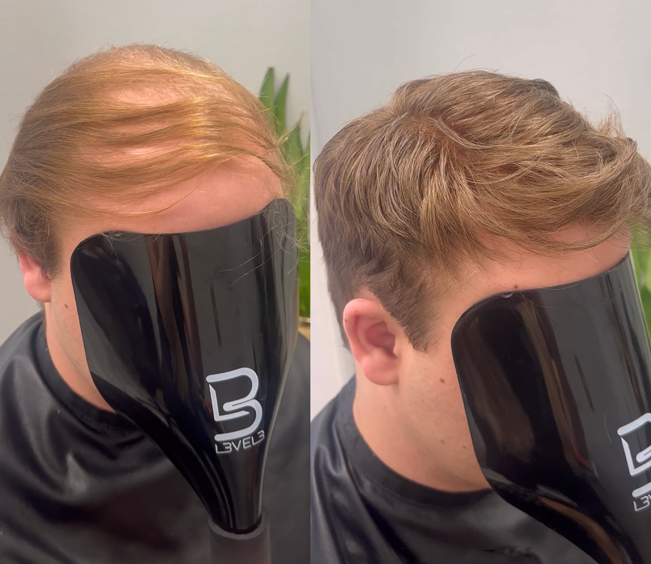 Men's hair system transformation from thinning hair to a curly style in Kenosha