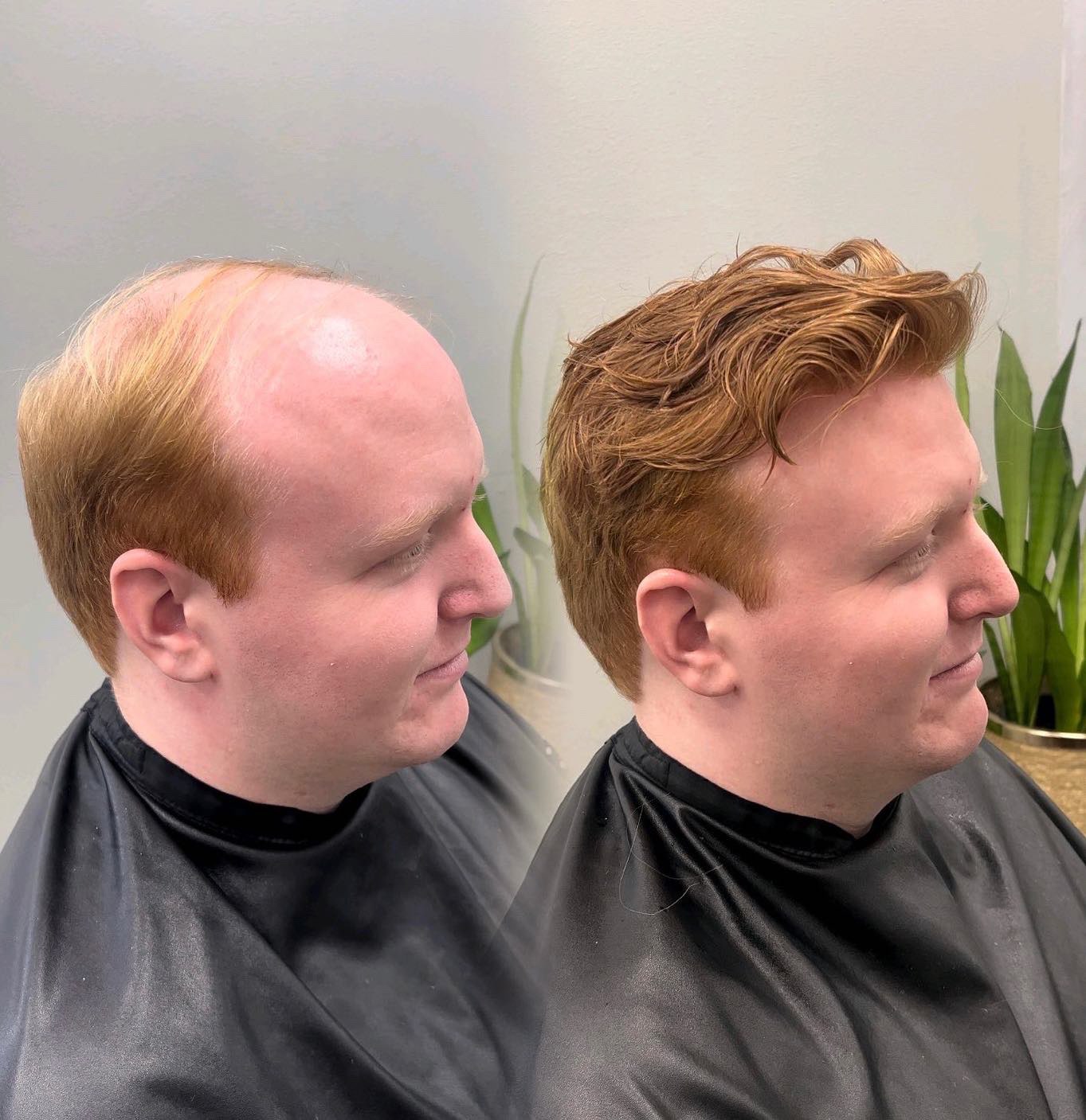 Red-haired client hair system before-and-after result in Kenosha, Wisconsin
